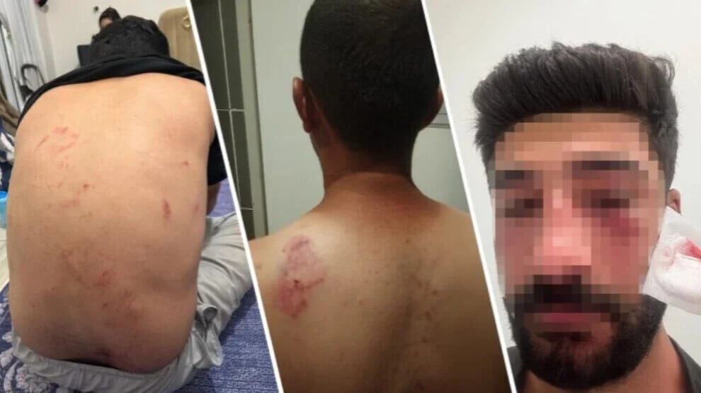 عائلة كوردية تتعرّض للاعتداء من قبل عنصريين أتراك في مرسين بسبب التحدث باللغة الكوردية!