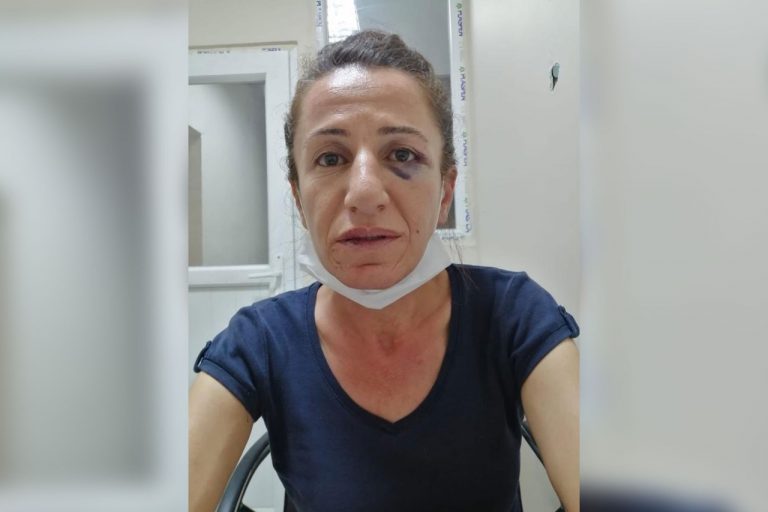 Rojbîn Çetîn