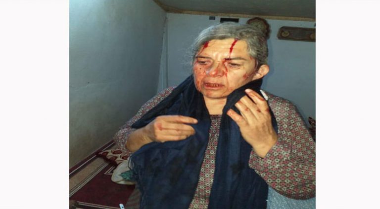 چەکدارێن PYD ئێریشی گوندەکی کرن و سەرێ ژنەکا کورد شکاندن