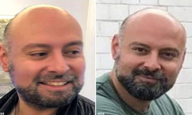 زەلامەکی ترک دەولەتا ئەلمانیا ب 45 ملیۆن یورۆیان خاپاند و رەڤیا